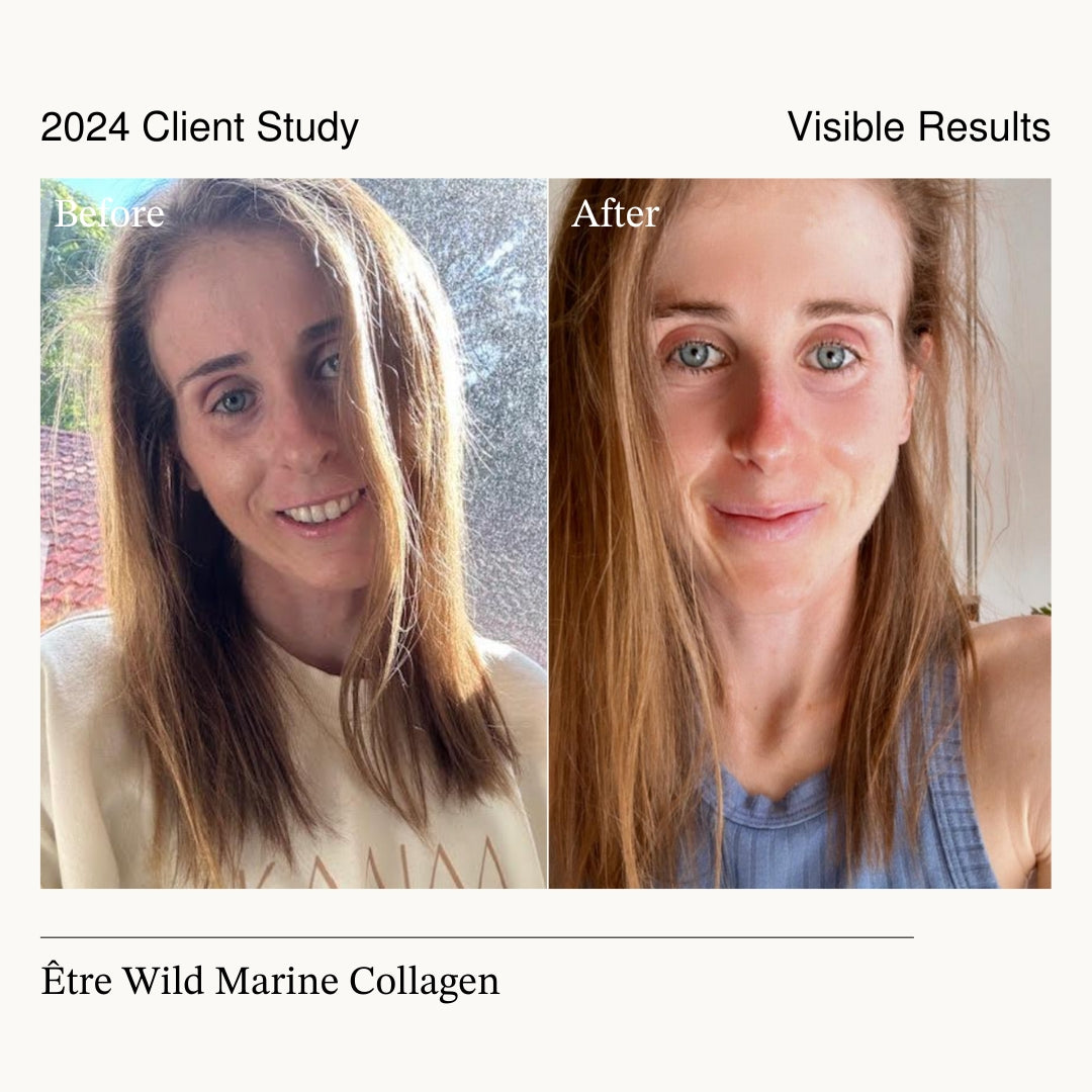 Glow & Beauty | Wild Marine Collagen